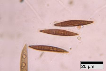 R_necatrix_JFM9335_sheath1_JFM
