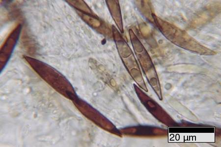 R_necatrix_JFM9335_spores1_JFM